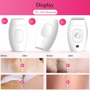 Vitaaly Silky Skin 1 - Laser Hair Removal Handset